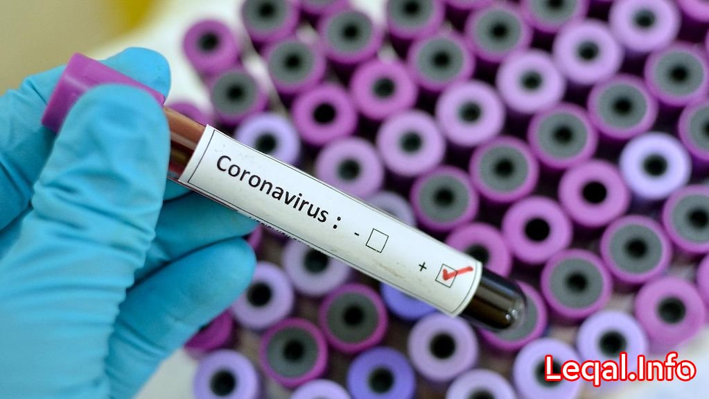 Azərbaycanda koronavirusdan ölənlərin yaş göstəriciləri açıqlandı