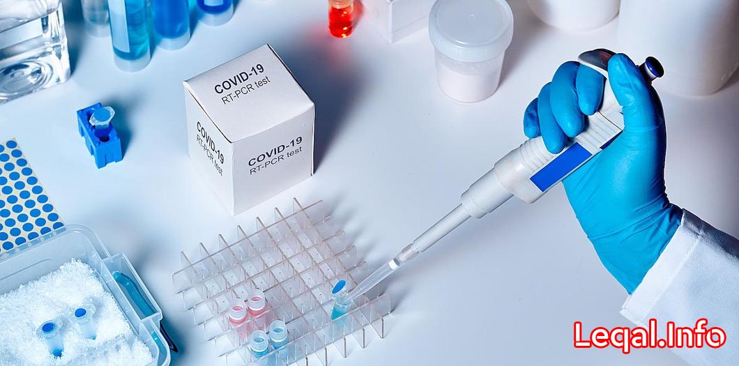 Deputatların koronavirus testinin nəticələri açıqlanıb