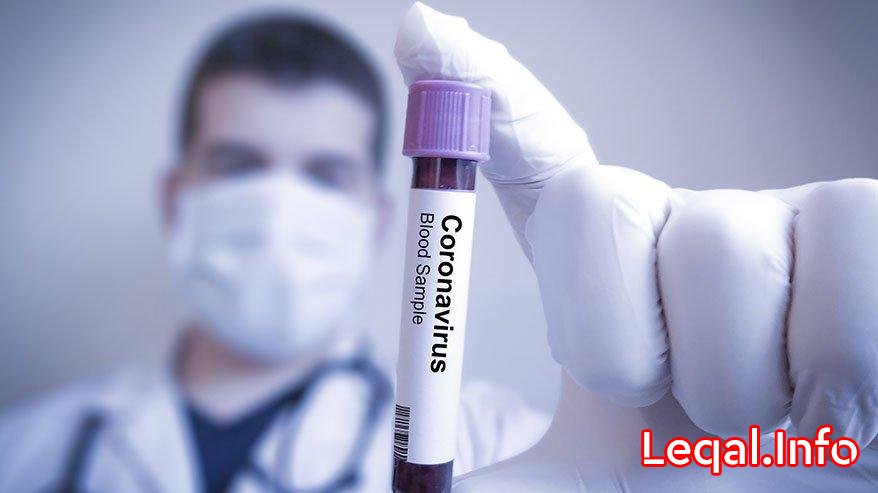Azərbaycanda daha 556 nəfər koronavirusa yoluxdu , 7 nəfər öldü