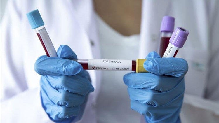 Azərbaycanda evdə müalicə olunan koronavirus xəstələrinin sayı açıqlandı