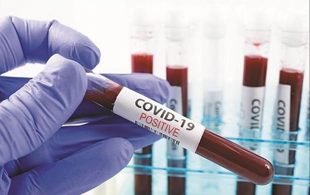 Son sutkada 45 nəfər koronavirusdan öldü