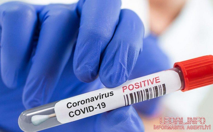 Azərbaycanda daha 1 997 nəfər koronavirusa yoluxub, 31 nəfər ölüb