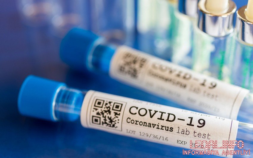 Azərbaycanda daha 577 nəfər koronavirusa yoluxub, 9 nəfər ölüb