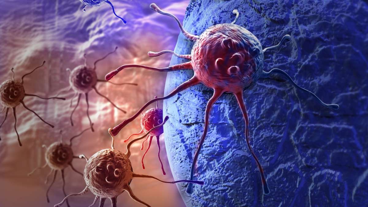 AstraZeneca” xərçəngin müalicəsi üçün dərman hazırlayan şirkəti alıb