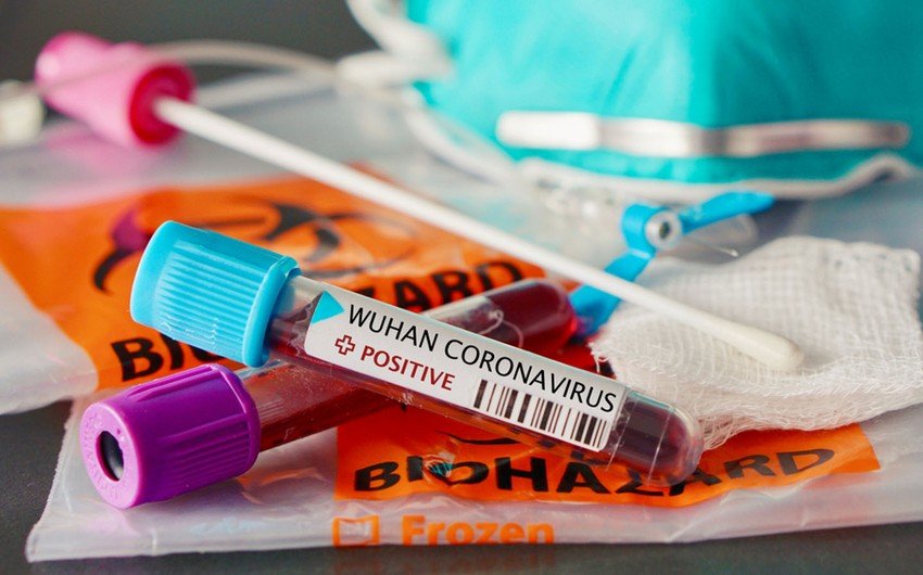 Son sutkada Azərbaycanda 337 nəfər koronavirusa yoluxub, 6 nəfər ölüb