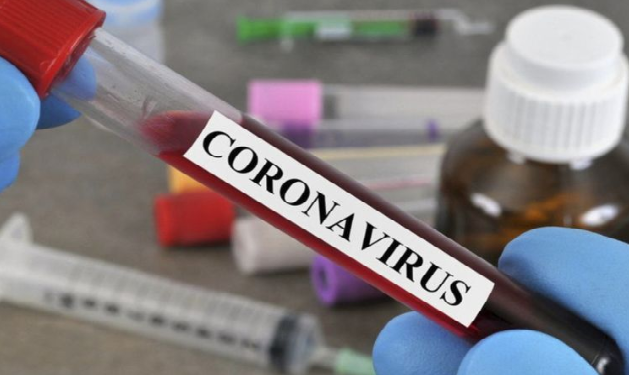 Son sutkada Azərbaycanda 164 nəfər koronavirusa yoluxub, 3 nəfər ölüb