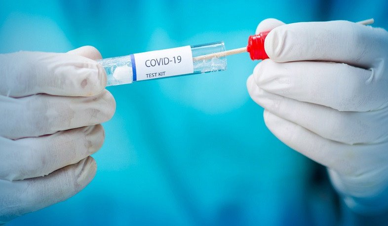 Azərbaycanda koronavirusa daha 49 yoluxma faktı qeydə alınıb