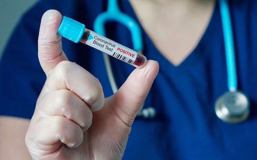 Azərbaycanda son gün ərzində 37 yeni yoluxma qeydə alınıb